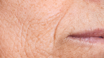 How to prevent and reduce wrinkles naturally? bentica.