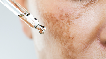 How to treat hyperpigmentation effectively? bentica.