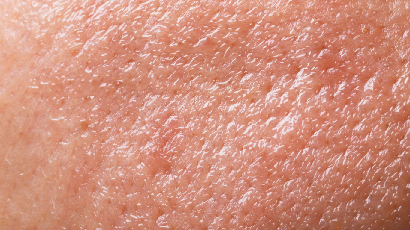 Oily Skincare with Bentica.