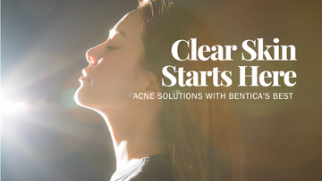 Clear & Calm Bundle: The ultimate anti-acne solution by Bentica for glowing skin.