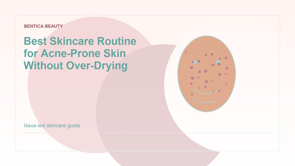 Illustration of acne-prone skin care without over-drying the face