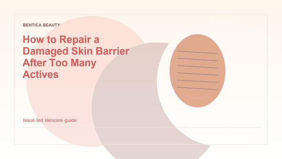 Illustration of a calm skin barrier being repaired after overuse of active skincare ingredients