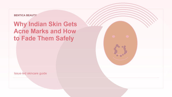 Illustration of acne marks on Indian skin fading safely with a gentle skincare routine