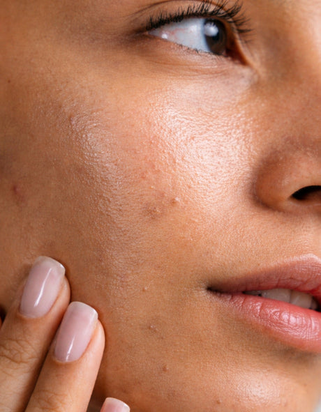 Dull, Rough and Textured Skin